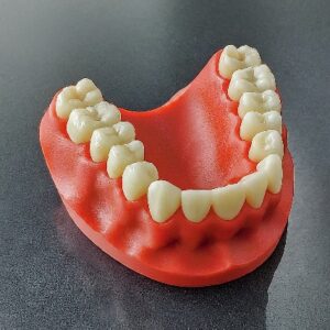 dental 3d model protomont