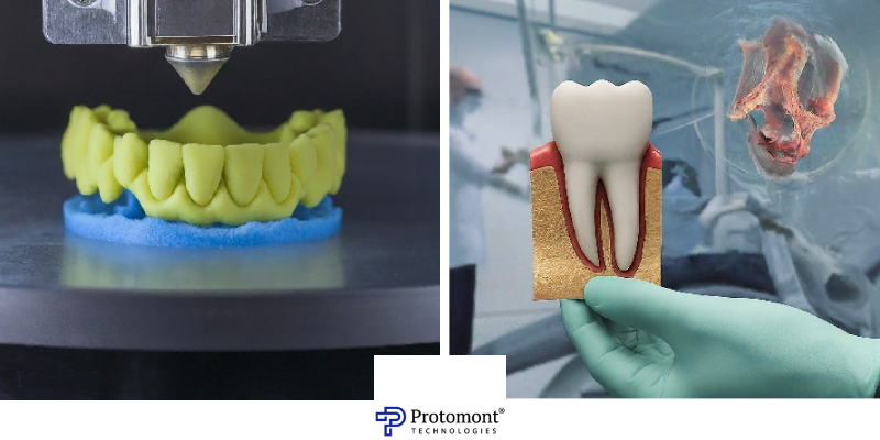 dental 3d printer blog protomont