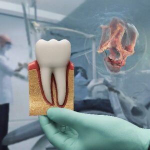 dental 3d printer teeth model protomont